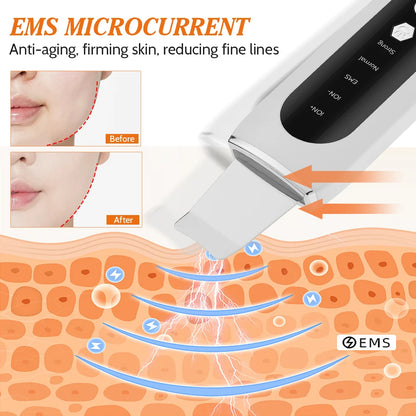 Hailicare Ultrasonic Facial Skin Scrubber
