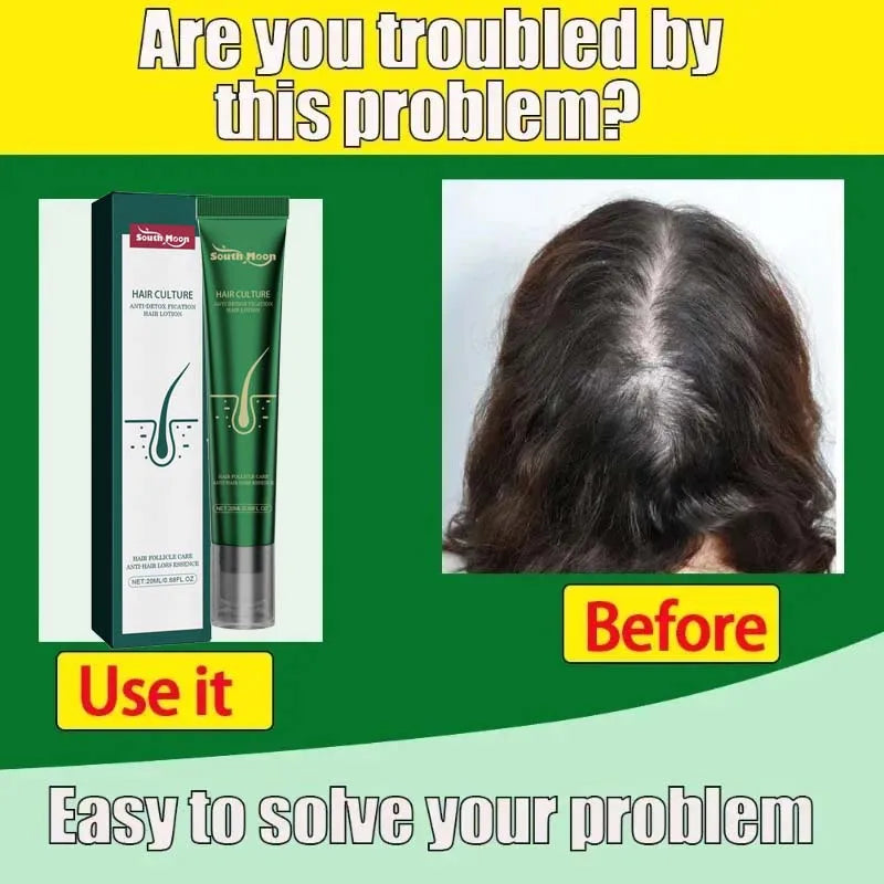 FolliBoost Biotin Scalp Serum