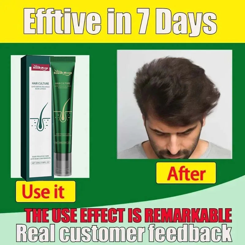 FolliBoost Biotin Scalp Serum