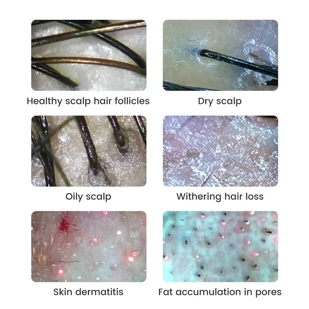 Dermatoscope Skin Analyzer Machine Digital Microscope Camera WiFi Wireless Electron Scalp Detection Pores Magnifier Facial 1000X