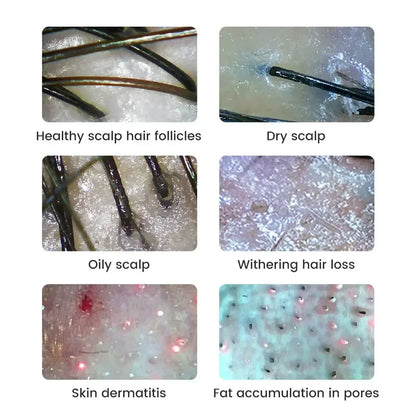 Dermatoscope Skin Analyzer Machine Digital Microscope Camera WiFi Wireless Electron Scalp Detection Pores Magnifier Facial 1000X