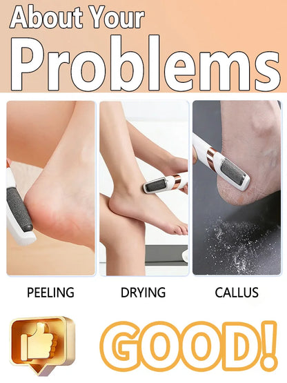 Pro-Smooth Electric Callus Remover