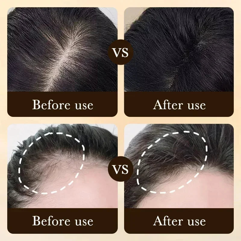 FolliBoost Biotin Scalp Serum