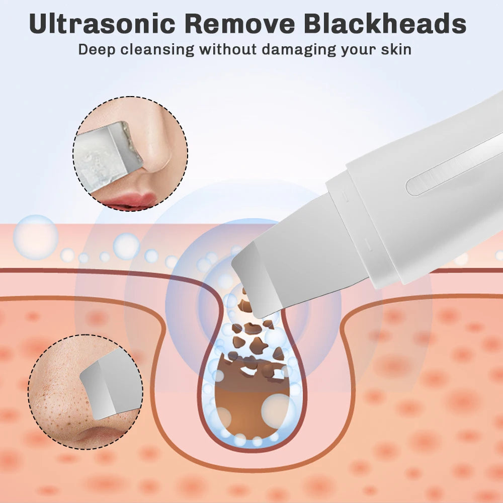Hailicare Ultrasonic Facial Skin Scrubber