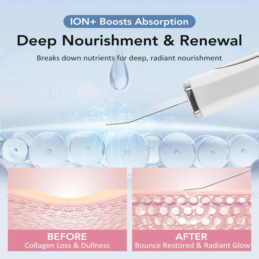 Hailicare Ultrasonic Facial Skin Scrubber
