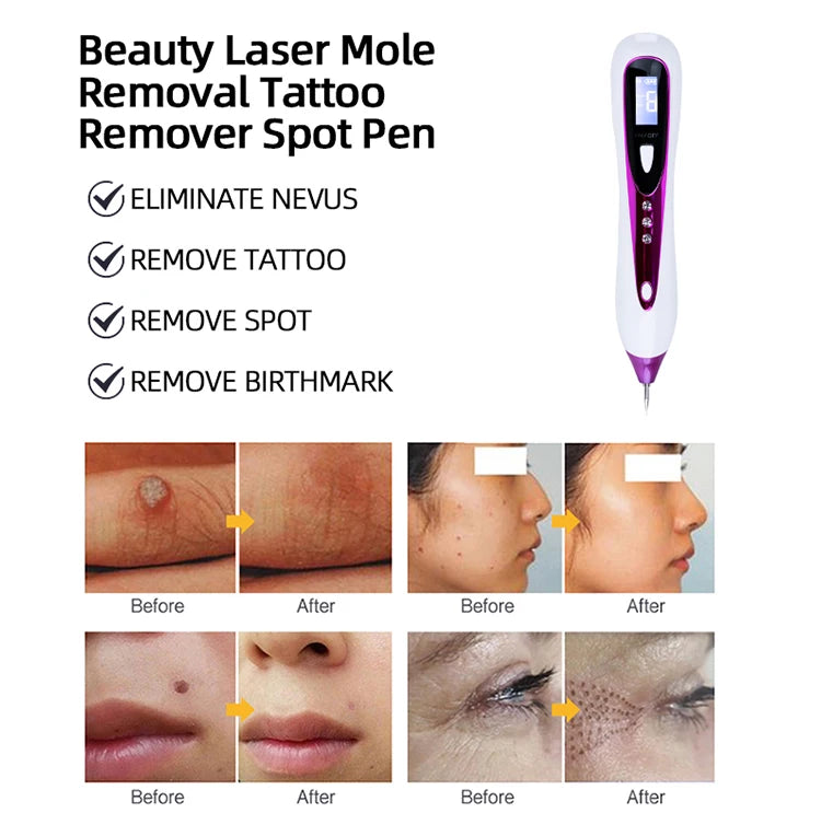 Precision Plasma Spot Remover