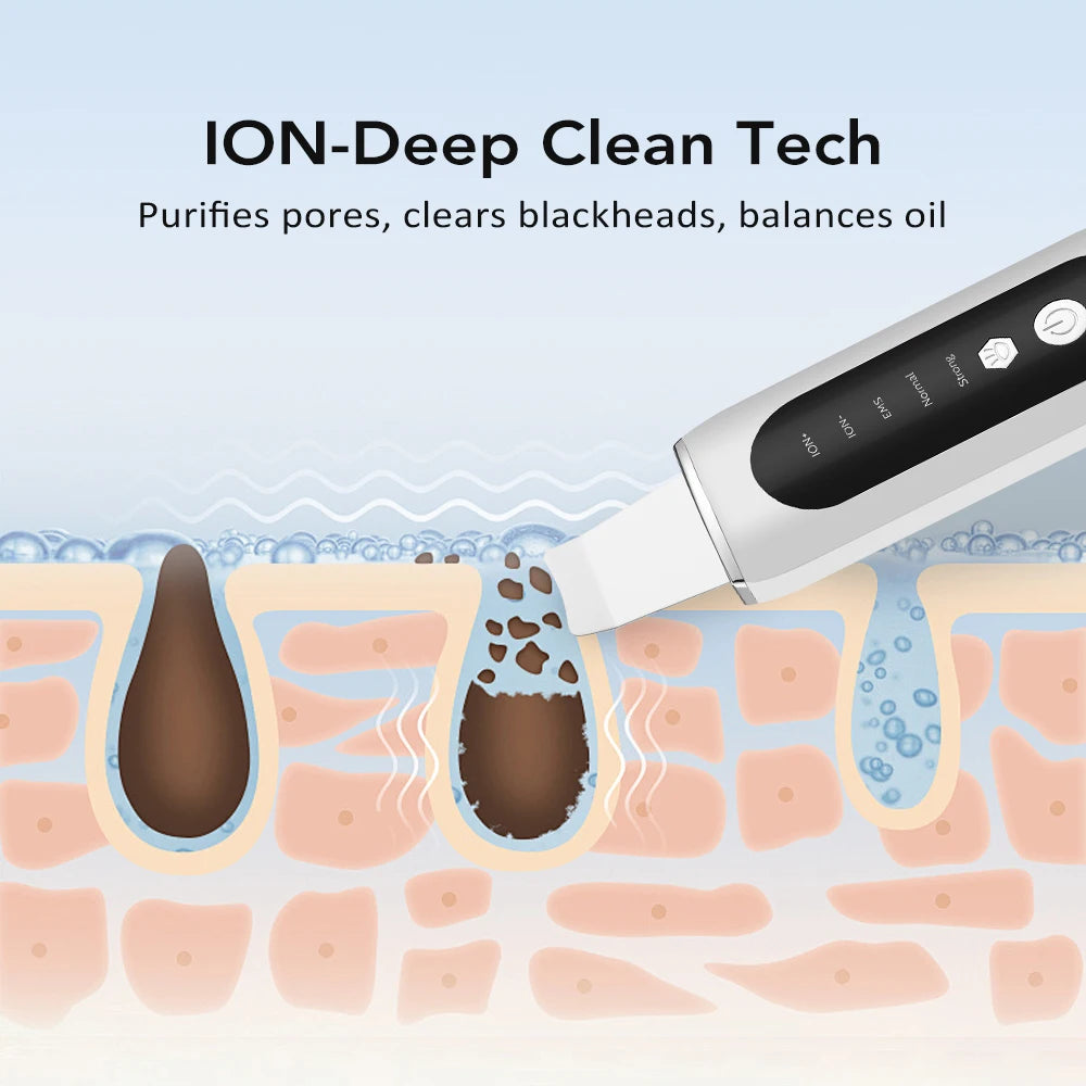 Hailicare Ultrasonic Facial Skin Scrubber