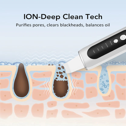 Hailicare Ultrasonic Facial Skin Scrubber